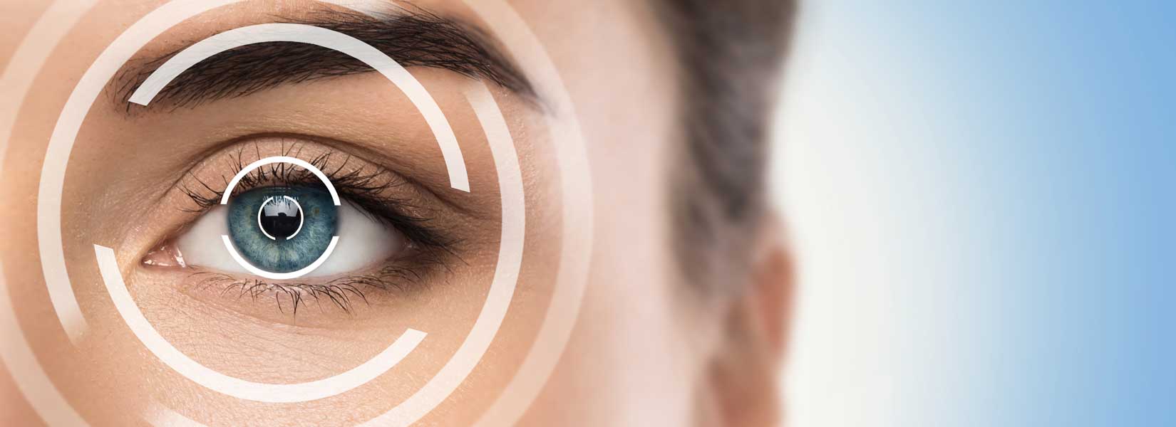 LASIK & Refractive Surgery Co-Management in Pittsfield