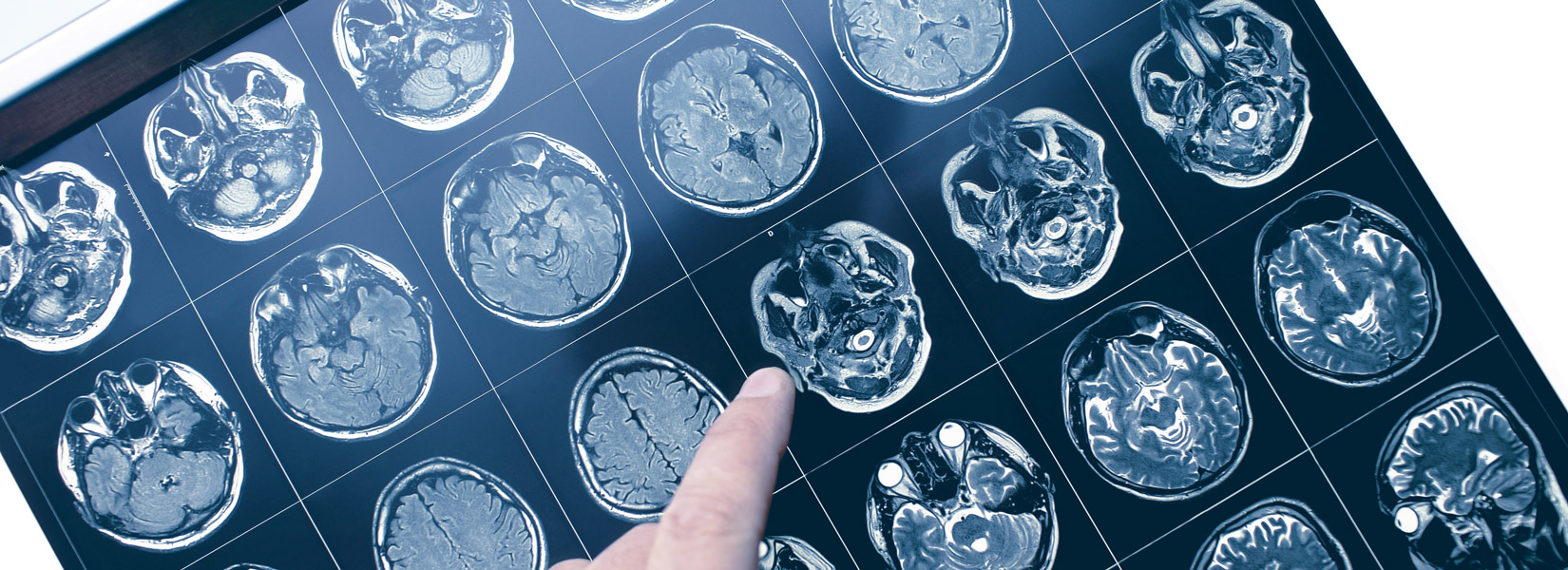 Neuro-Optometry in Pittsfield